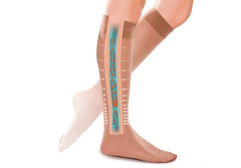 el efecto de las medias de compresión en las piernas con varices