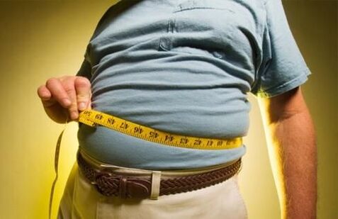 El exceso de peso provoca el desarrollo de venas varicosas. 