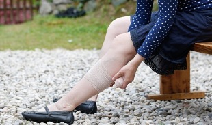 Síntomas de varices en las piernas en mujeres. 